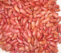 Gujarat Foods Kidney Beans [LIGHT] 55LBS